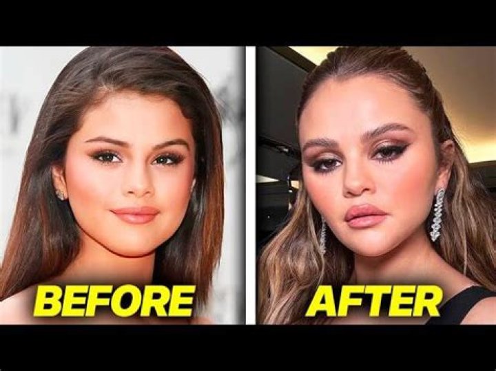 Did Selena Gomez Get Plastic Surgery? Exploring The Evidence And Rumors